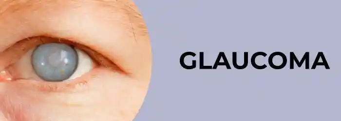 5 important factors to recognize glaucoma